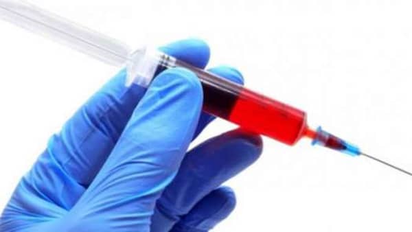 تحليل pcr