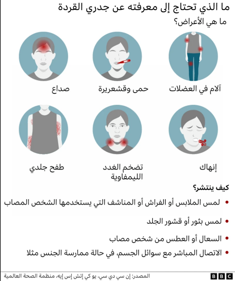 جدري القرود