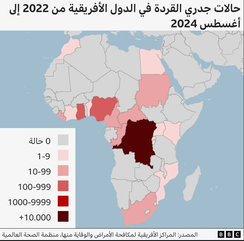 جدري القرود