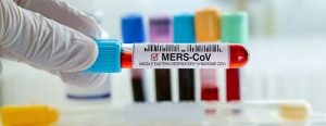 متلازمة الشرق الأوسط التنفسية (MERS)