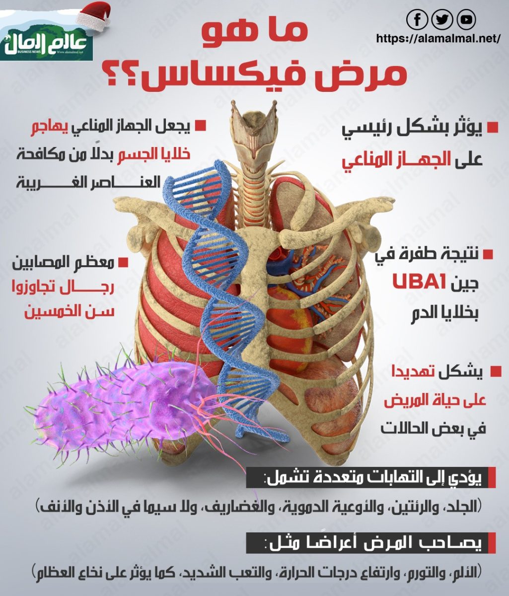 مرض فيكساس